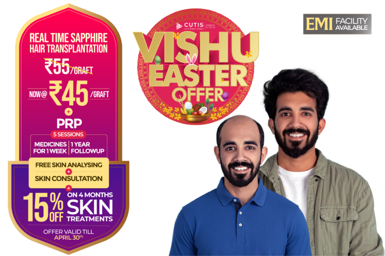 Vishu Easter offer Real Time Sapphire hair transplant at Cutis International Cosmetic Clinics now ₹45 per graft including PRP 5 sessions medicines for 1 week 1 year follow up free skin analysing and free skin consultation with 15 percent off on 4 months skin treatments offer valid till April 30