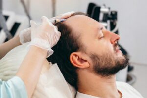 Does Hair Transplant Have Side Effects? Everything You Need to Know