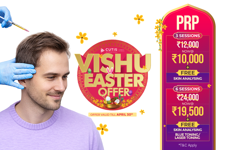 PRP hair treatment offer at Cutis International Cosmetic Clinics – Vishu and Easter special discount on PRP therapy for hair loss with 3 sessions at ₹10,000 and 6 sessions at ₹19,500 including free skin analysis and laser toning.