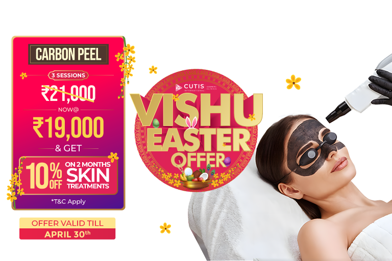 Vishu Easter offer Carbon Peel skin treatment at Cutis International Cosmetic Clinics for acne pigmentation and dull skin with 3 sessions ₹19,000 plus 10 percent off on additional skin treatments offer valid till April 30