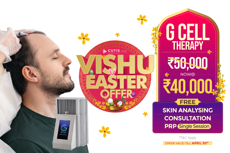 Vishu Easter offer G Cell Therapy treatment at Cutis International Cosmetic Clinics now ₹40,000 including free skin analysing free consultation and free PRP single session offer valid till April 30 terms and conditions apply