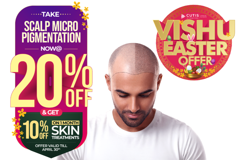 Vishu Easter offer Scalp Micro Pigmentation treatment at Cutis International Cosmetic Clinics with 20 percent off for natural hairline effect and fuller hair look plus 10 percent off on 1 month skin treatments offer valid till April 30