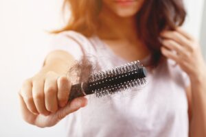 Why Am I Losing Hair? The Top 10 Causes Everyone Should  Know.